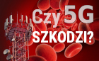Czy sieć 5g szkodzi zdrowiu? Tłumaczy inżynier elektronik Sergiusz Diundyk - Czytaj artykuł na blogu informatycznym Sergiusza Diundyka.